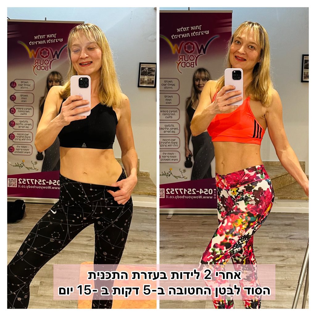 ג'ני קפלן - פאוץ' אחרי לידה לפני ואחרי 2 לידות