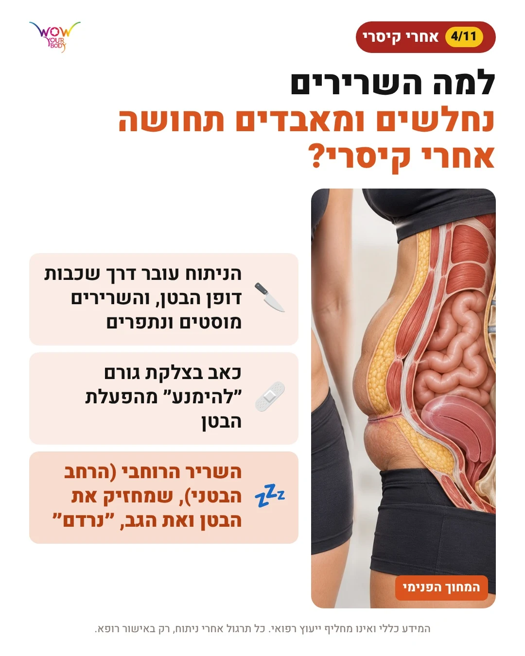 איור אנטומי: למה שרירי הבטן נחלשים ומאבדים תחושה אחרי ניתוח קיסרי