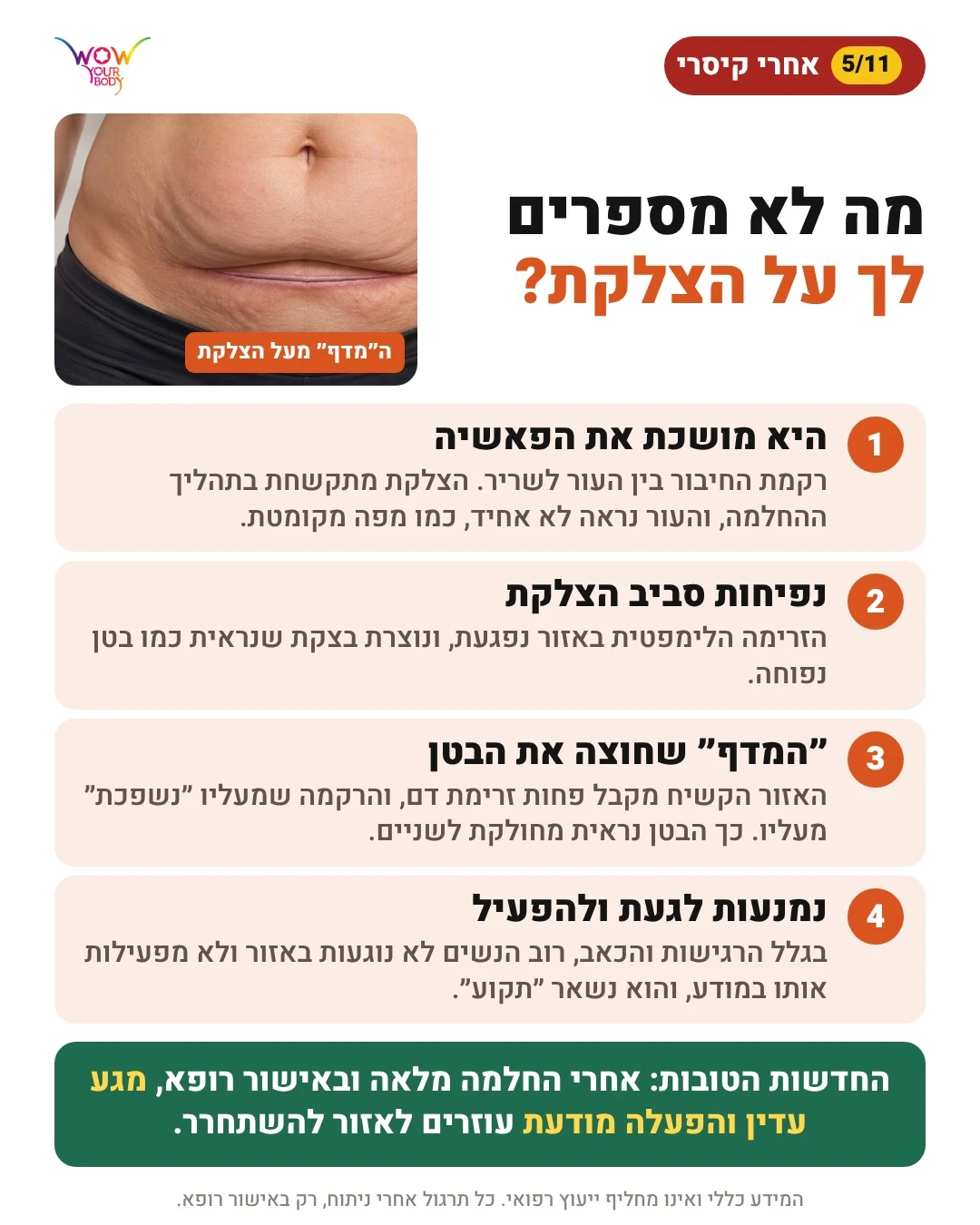 מה לא מספרים לך על צלקת הקיסרי: פאשיה, בצקת והמדף שחוצה את הבטן