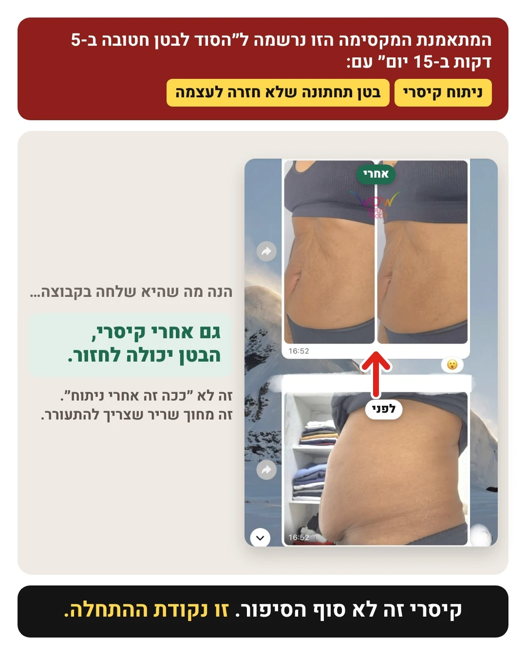 עדות מתאמנת אחרי קיסרי: תמונות לפני ואחרי של הבטן התחתונה